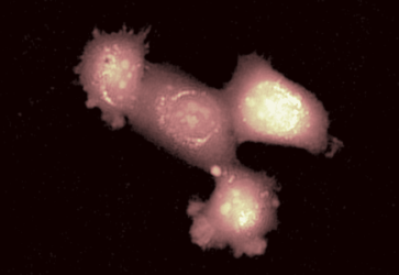 DHM image